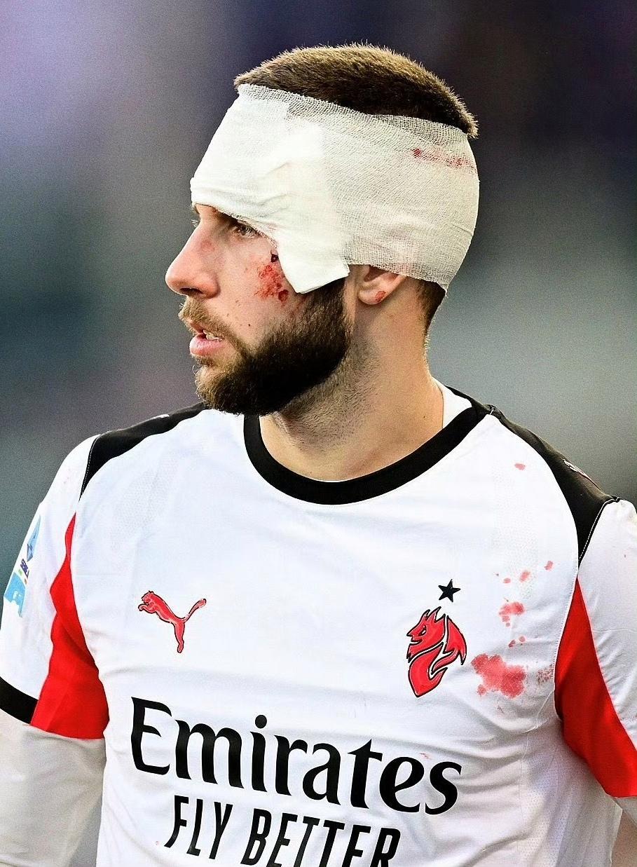 开云-爱游戏-老当益壮！米兰25场伤退23人次，40岁魔笛出勤率前3不在其中